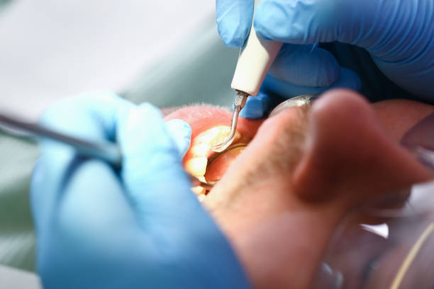 Best Cracked Tooth Emergency Dentist  in Corpus Christi, TX