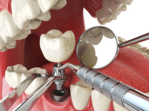 Best Knocked-Out Tooth Emergency  in Corpus Christi, TX
